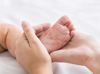 専門的なアレルギー検査と 治療に対応