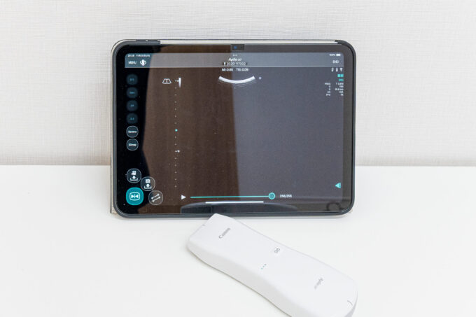 超音波診断装置